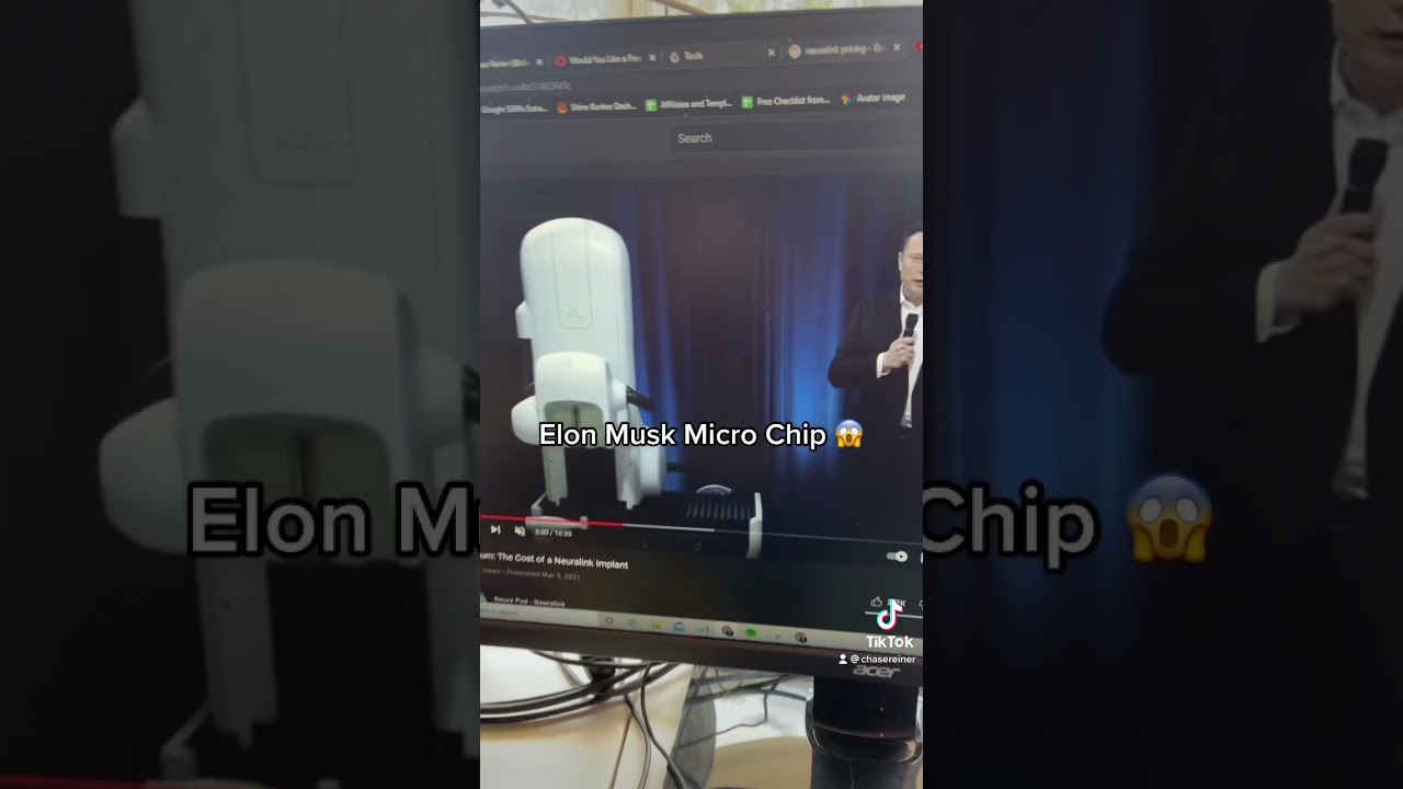 image 0 Elon Musk Micro Chip 😱